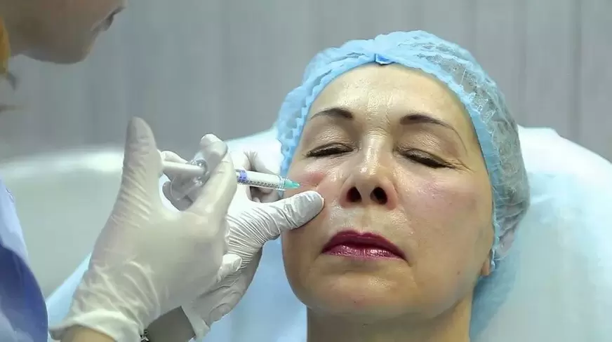 Bioaumento Rejuvenecimiento Facial